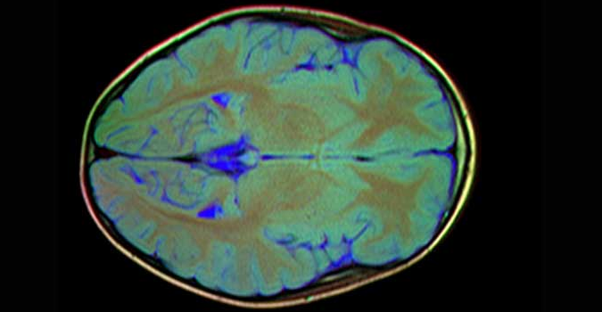 Brain MRI Cost in Kanpur